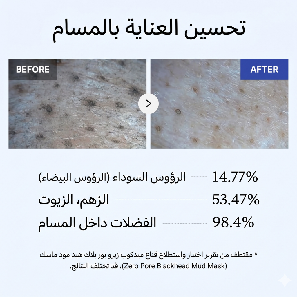MEDICUBE- Zero Pore Blackhead Mud Mask