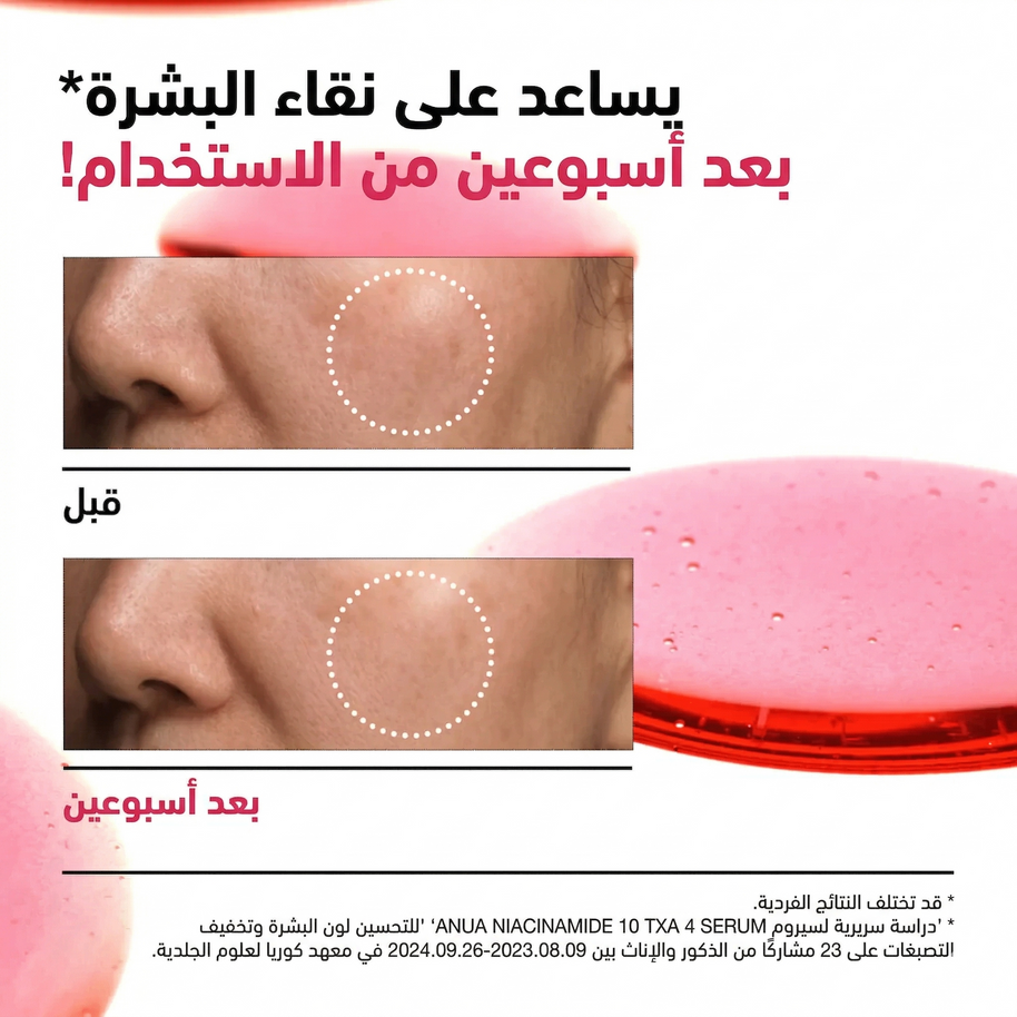 Anua - Niacinamide 10 TXA 4 Serum