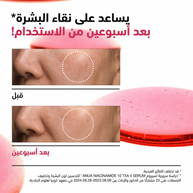 Anua - Niacinamide 10 TXA 4 Serum