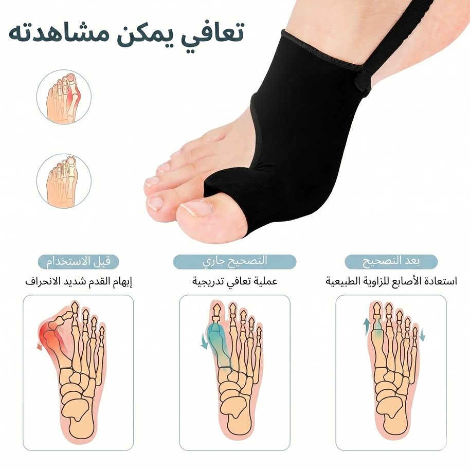 المصحح المتطور لإبهام القدم (متعدد الاستخدامات)