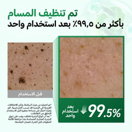 Heartleaf Quercetinol Pore Deep Cleansing Foam