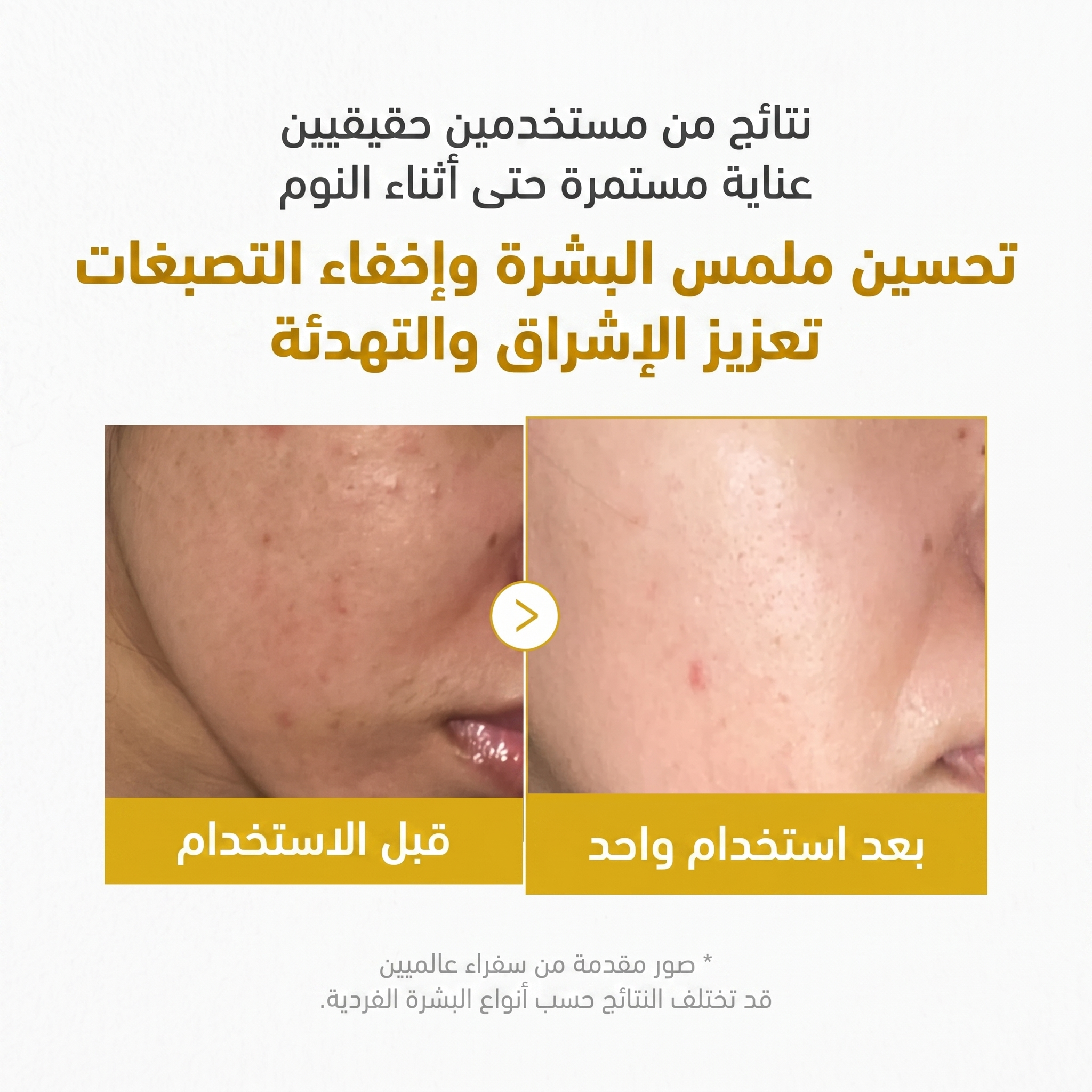 MEDICUBE - Kojic acid turmeric night wrapping mask