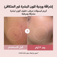 MEDICUBE - PDRN Pink Collagen Gel Cream