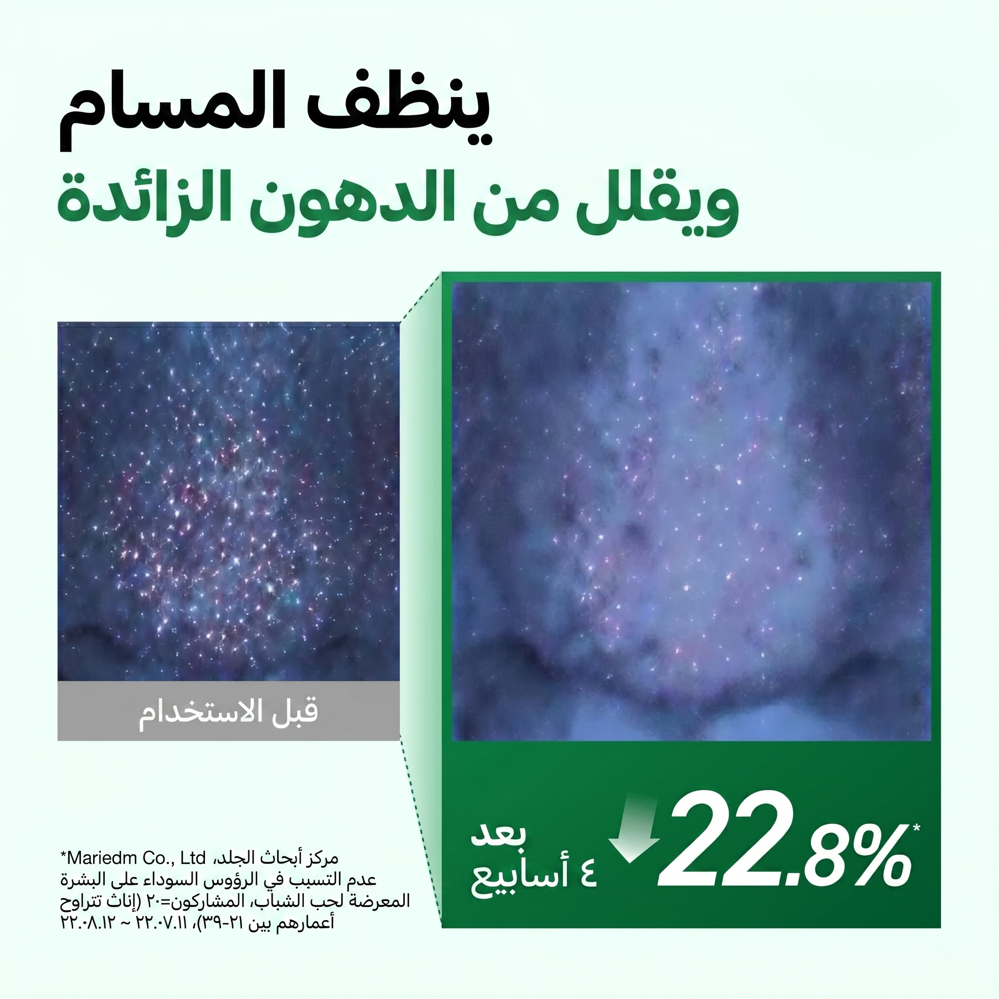 Anua - Heartleaf Pore Control Cleansing Oil